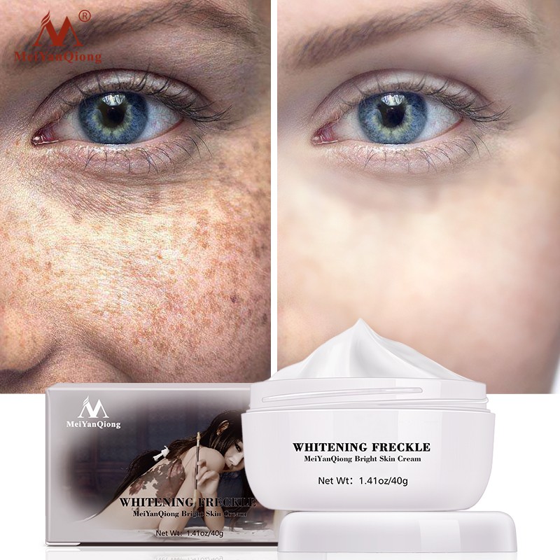 skin ointment for dark spots