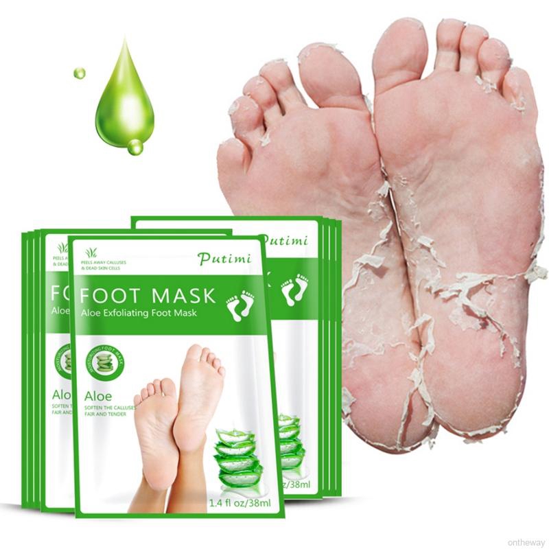 baby feet skin peel