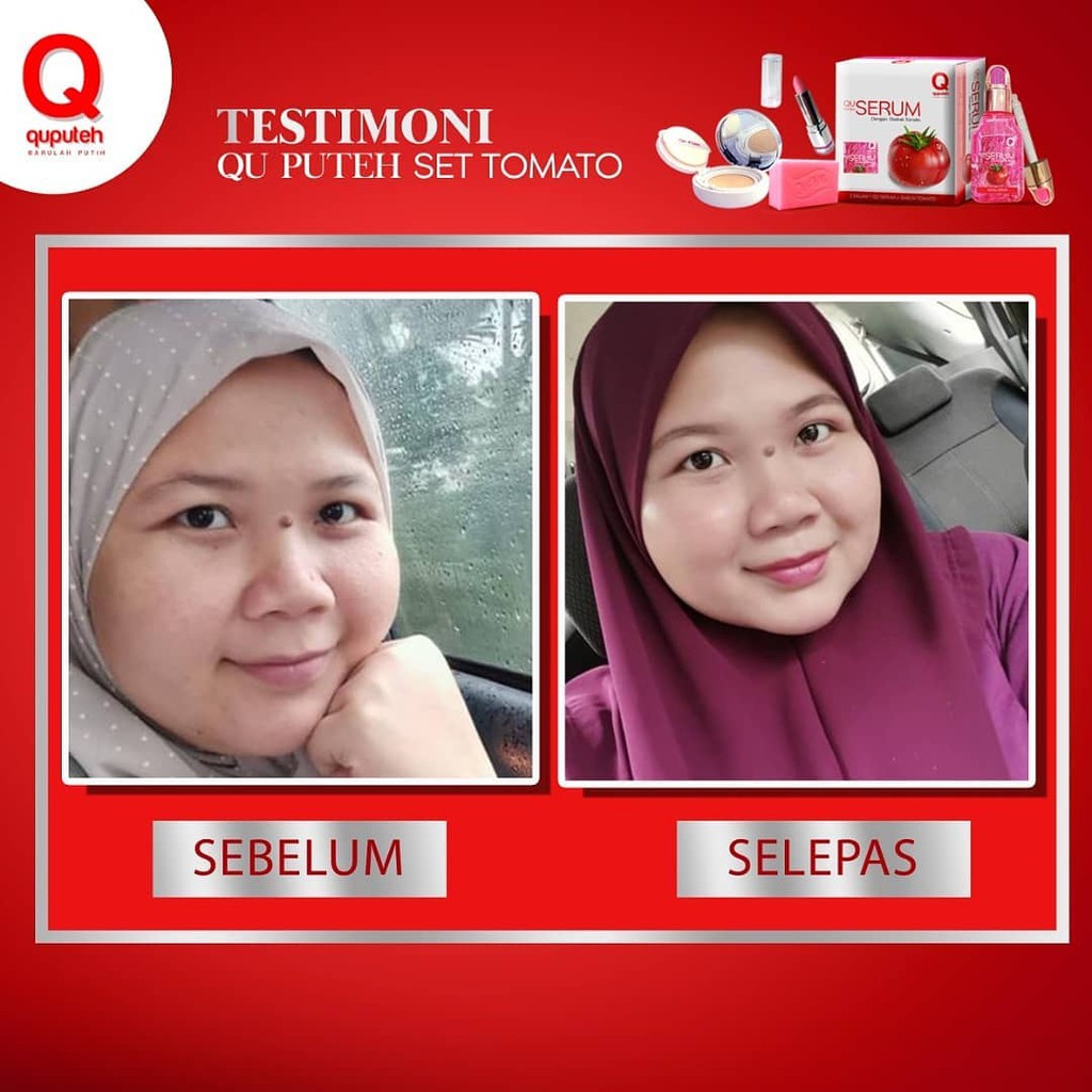 Dsv Qu Puteh Tomato Serum Combo Sale Shopee Singapore