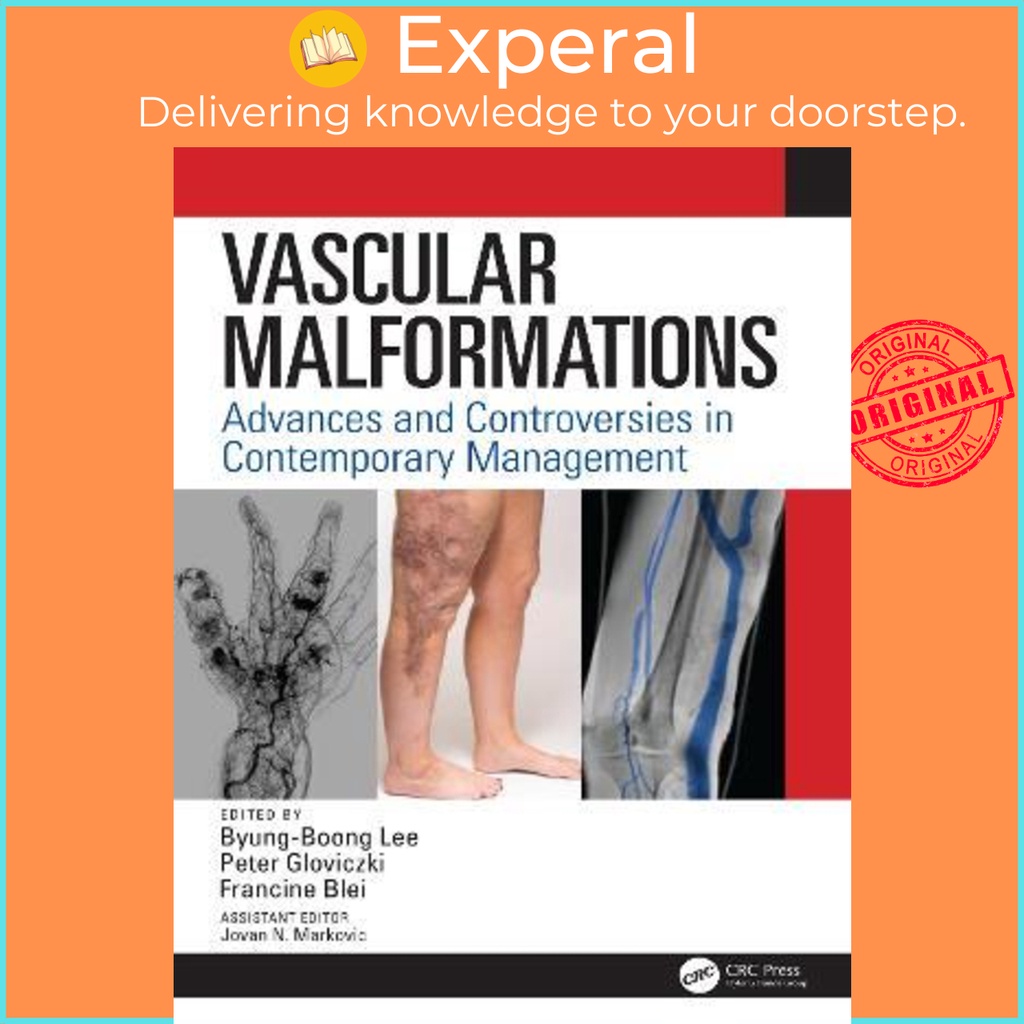 Vascular Malformations : Advances and Controversies in 