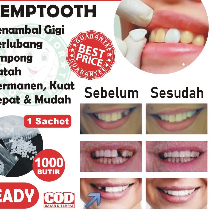 Temptooth Denture Fill Curleb 1000 Grains Ompong Teeth / Broken Teeth ...