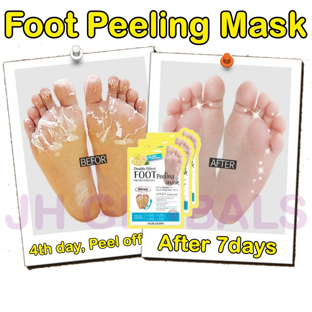 foot peel products