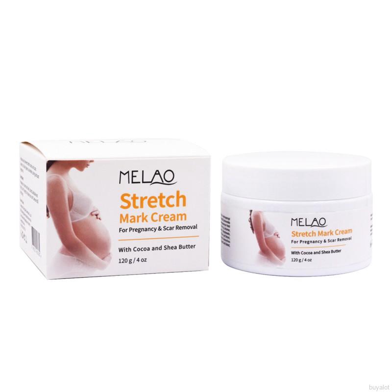 stretch mark cream removal