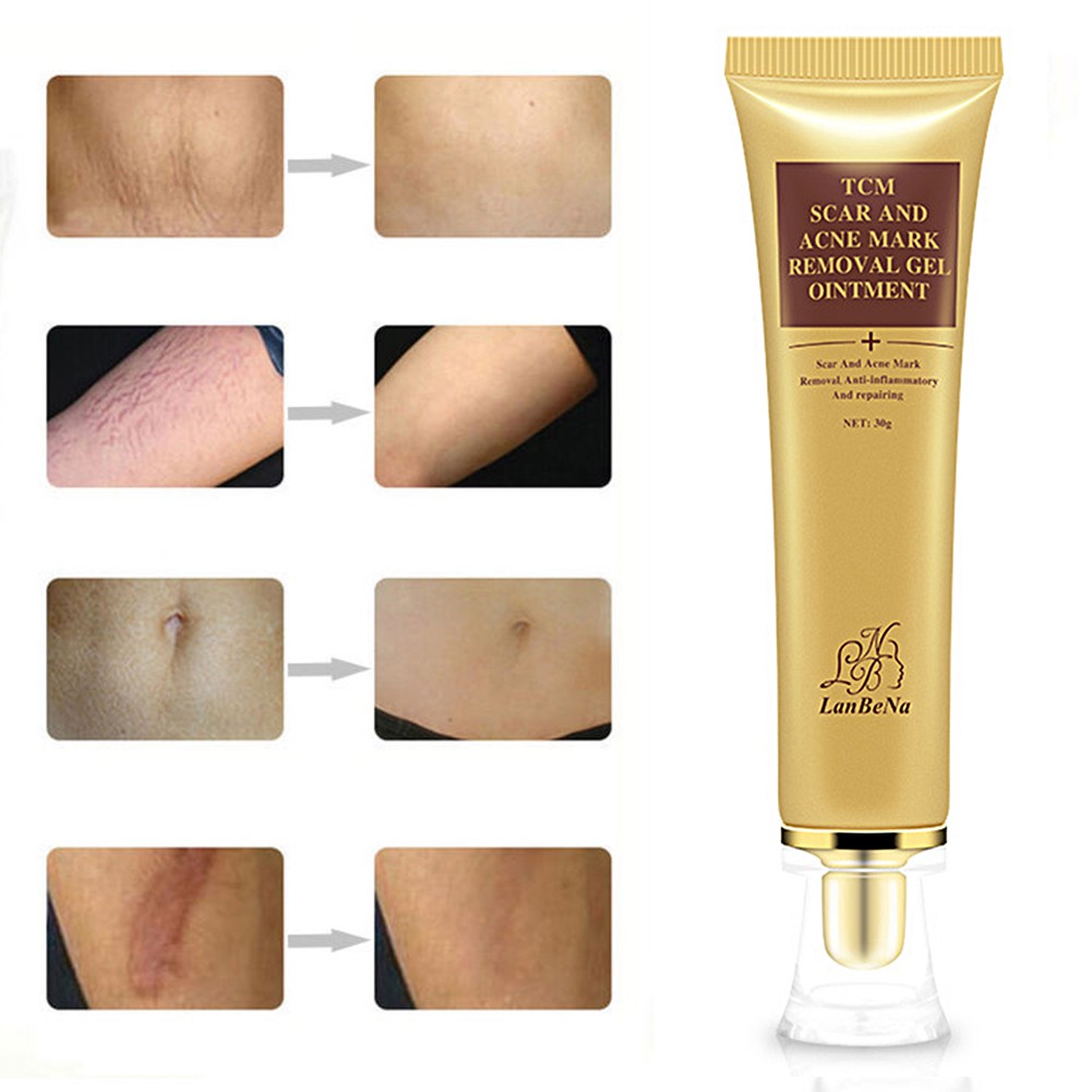 lanbena scar cream