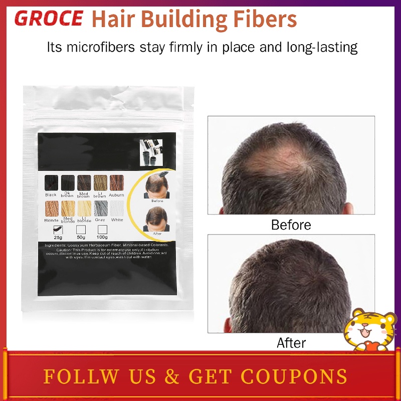 Groce Hair Building Fiber Thickener Loss Solution Concealer Fuller | Shopee  Singapore