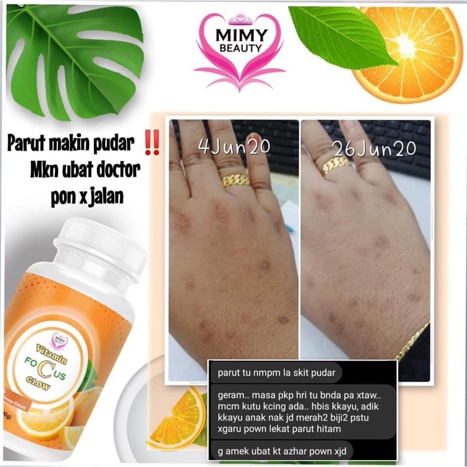 Vitamin C Glow Focus Mimy Beauty Shopee Singapore