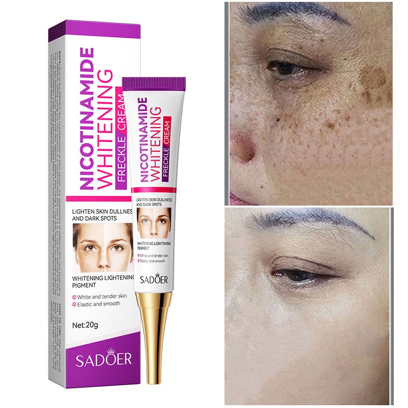 Nicotinamide Whitening Freckle Cream Face Moisturizing Remove Dark