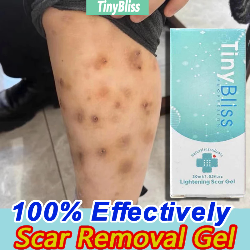 TinyBliss Lightening Scar Gel Natural Soothing Gel Soften scarred skin effectiv Treatment Scar 30ml