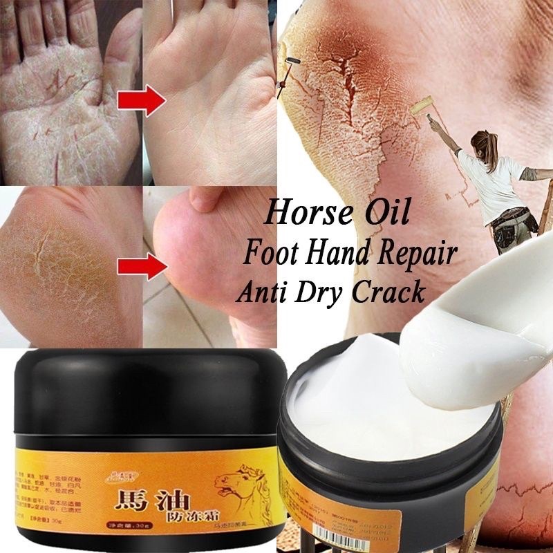 Horse Oil Foot Cream/ Moisturize/ Reduce dryness, itch, relieve redness ...