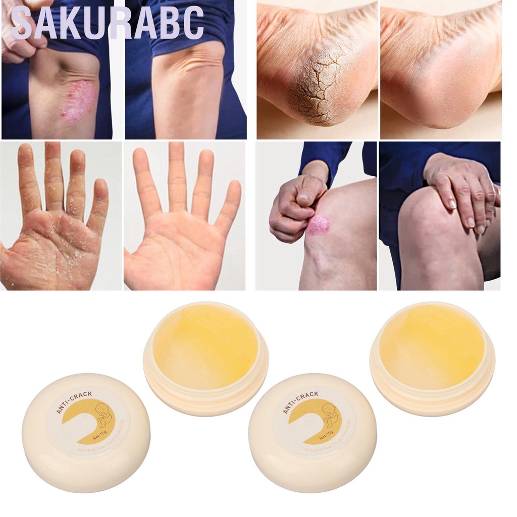 Image of Sakurabc 2pcs 0.5oz Cracked Heel Treatment Balm Moisturizing Foot Care Cream for Elderly #7