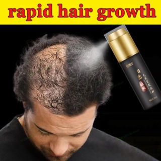 Hair Loss Treatment Fast Hair Growth Serum Hair Restore Hair Tonic  For Men Women Natural Gingseng Ginger Hair Regrowth Oil Original Magic Hair Regrowth Essence Product Health Hair Grow Liquid