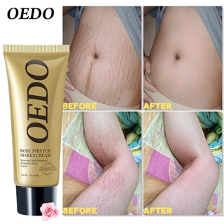 OEDO Rose Remove Stretch Marks Cream Anti Aging Skin Repair Remove Pregnancy Scars Treatment Body Skin Care 40g