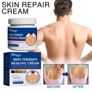 Skin Therapy Healing Cream Anti-Itch Antibacterial Psoriasis Treatment