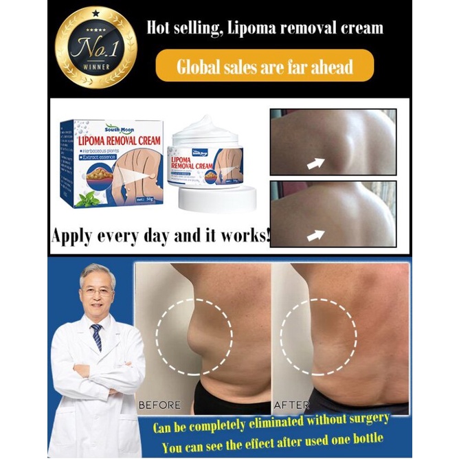Lipoma Removal Cream For Relieving Fat Lumps Hard Lumps Bulge And Eliminating Fatty Tumor 