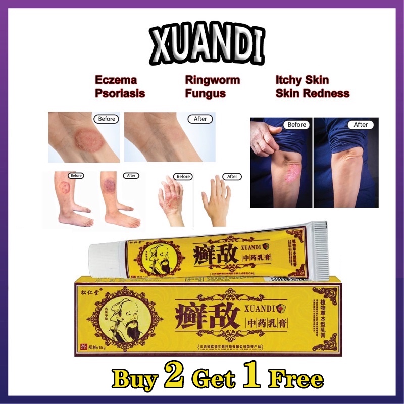 [First Aid] Xuandi Traditional Herbal Cream Antifungal Cream Ointment