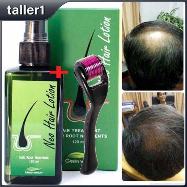 100 Original Thailand Neo Hair lotion Hair Growth Serum Hair Loss