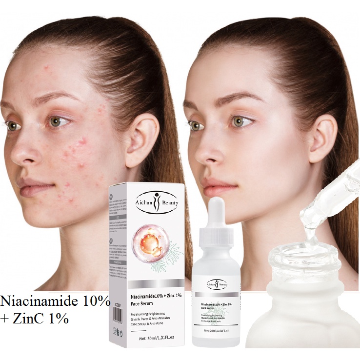 Serum Niacinaide Ngăn Ngừa Và Giảm Mụn, Dưỡng Trắng Da