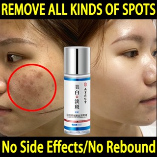 【SG Seller】Facial Freckle Removing  Whitening Age Dark Spots Acne Removing Scar Chloasma Lightening Liquid 100ML Moisture Removal for Men & Women
