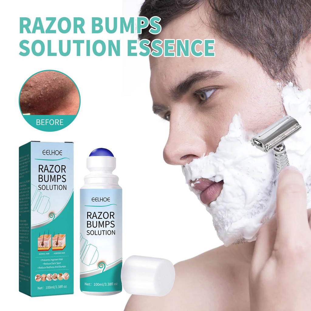 Razor Bump and Ingrown Hairs Serum After Shave Solution RollOn for