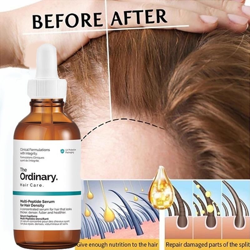 The Ordinary Hair Serum Hair Grower Essence Multi-Peptide Serum For Hair  Density Hair Growth Care | Shopee Singapore