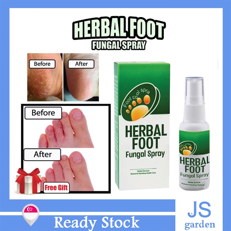Foot spray Fungus Foot deodorant spray Antibacterial Herbal Rotten feet