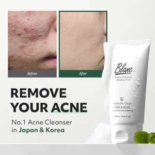 [ Blanc Nature Official ] Acne Pimple Face Cleanser Cleansing foam