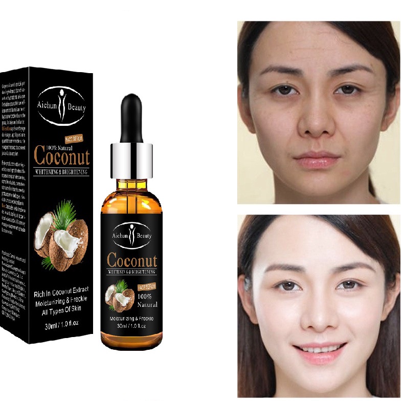 Serum Coconut Dừa Aichun Beauty Dưỡng Mềm Phục Hồi Da Giảm Nhăn Mờ Nám Tàng Nhan Dưỡng Trắng Sáng Da Đều Màu 30ml