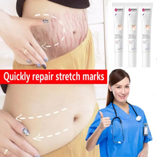 Stretch Mark Cream (20g)  FAST DELIVERY *Remove Stretch Marks Maternity Skin Repair *Reduce Pregnancy Scars Treatment* Safe Medical Formula & Does Not Irritate *Lighten Fine Lines & Moisturizing* Body Care Moisturizer