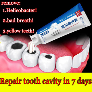 【Shipped in Singapore】Probiotic toothpaste removes bad breath Helicobacter flavus cavities teeth whitening elderly and children have used no side effects 100ml dental medicine certified flash spray Repair dental cavity 牙齿美白