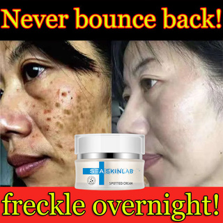 【Shipped in Singapore】3 days to arrive remove pigment dark spots scar moisturizing cream facial brightening Spot Removal Cream 30g 祛斑霜