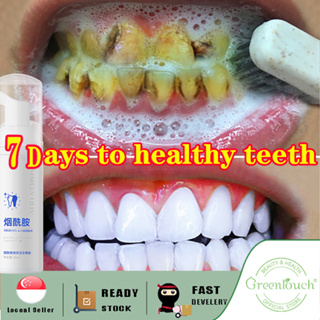 【SG Seller】Tooth Mousse Tooth Whitening Oral Hygiene Toothpaste Remove Stains Yellow Teeth whitening kids mouthwash & toothpaste whitening toothpaste