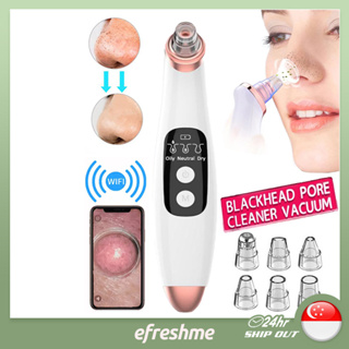 Blackhead Suction Vacuum Facial Pore Deep Cleaning Comedone Tool USB Rechargeable