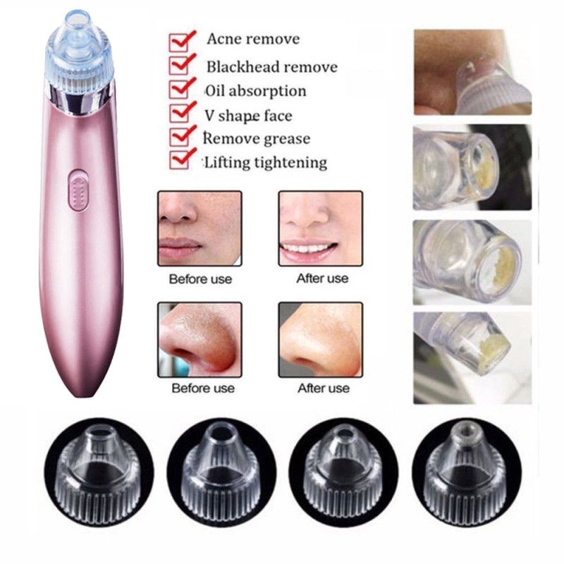 Electric Blackhead Remover Facial Skin Cleanser Acne Vacuum Suction Pore Cleaner Remove Blackhead